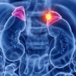Adrenal